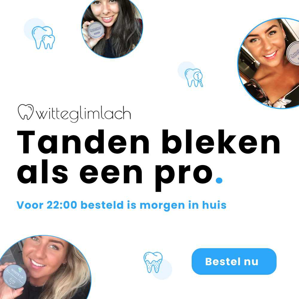 Witteglimlach.nl Kortingscode